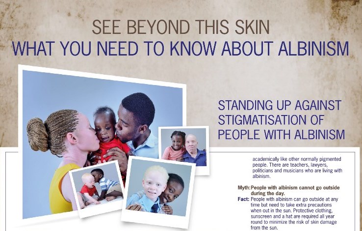 WorldAlbinismday